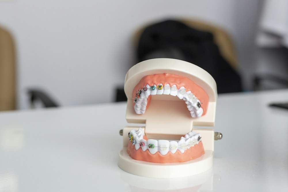 Modelo dental con brackets