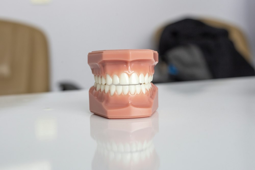 Modelo dental sobre una mesa