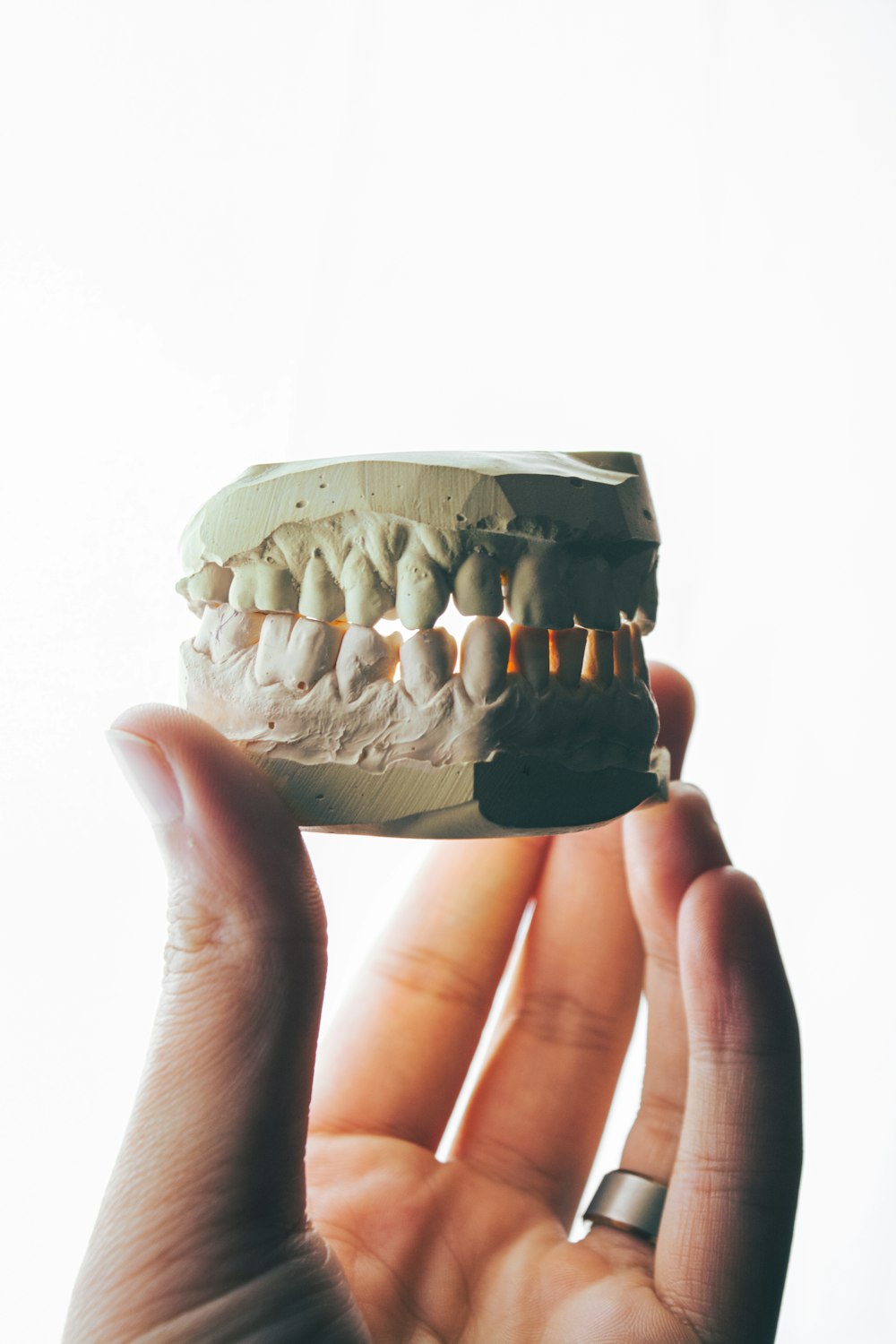 Modelo dental sostenido en una mano