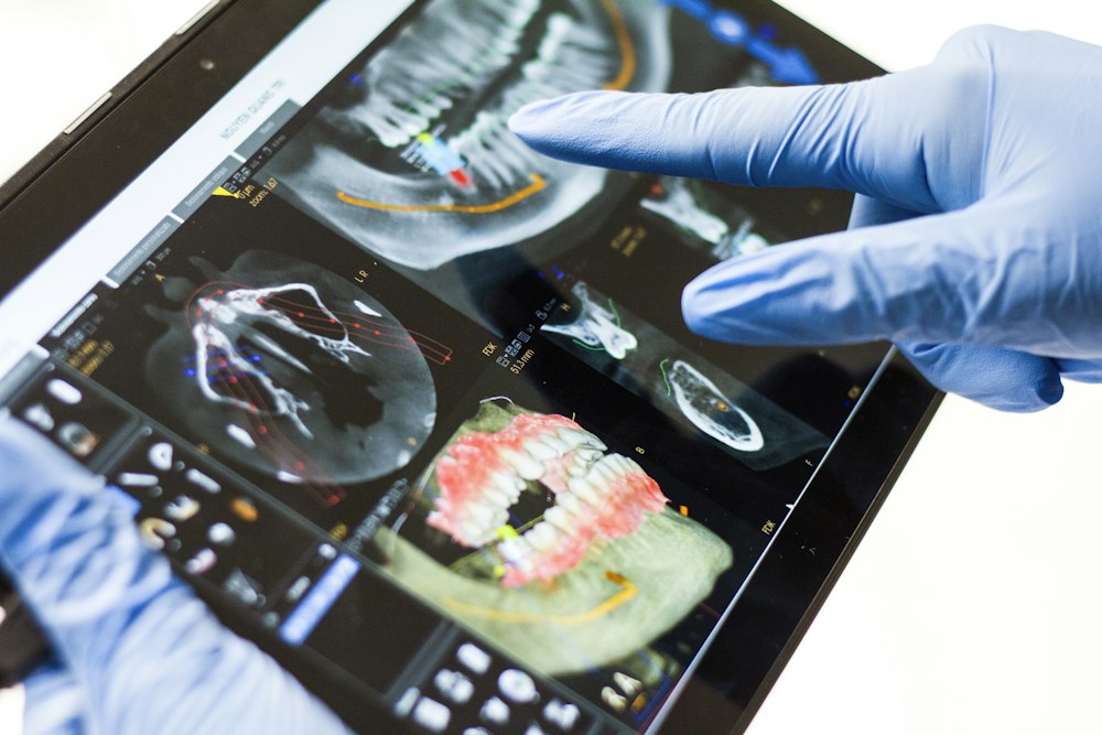 Radiografía dental revisada en una tableta en su comuna